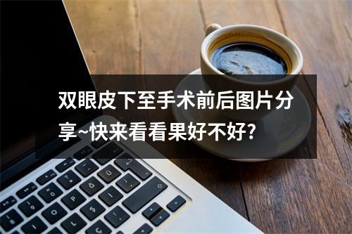 双眼皮下至手术前后图片分享~快来看看果好不好?