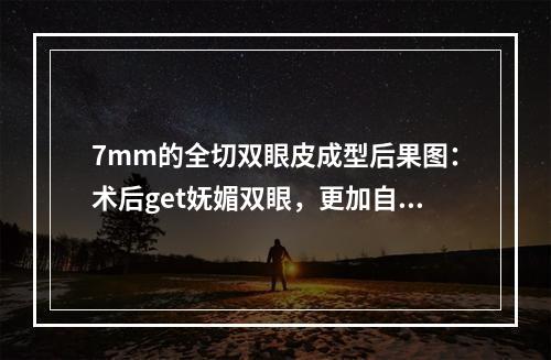 7mm的全切双眼皮成型后果图：术后get妩媚双眼，更加自信！