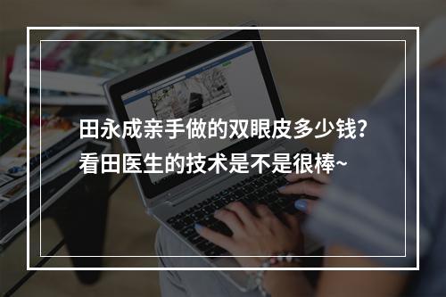 田永成亲手做的双眼皮多少钱？看田医生的技术是不是很棒~