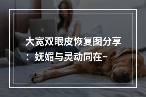 大宽双眼皮恢复图分享：妩媚与灵动同在~