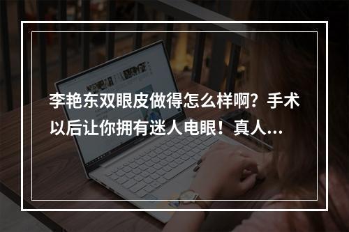 李艳东双眼皮做得怎么样啊？手术以后让你拥有迷人电眼！真人案例