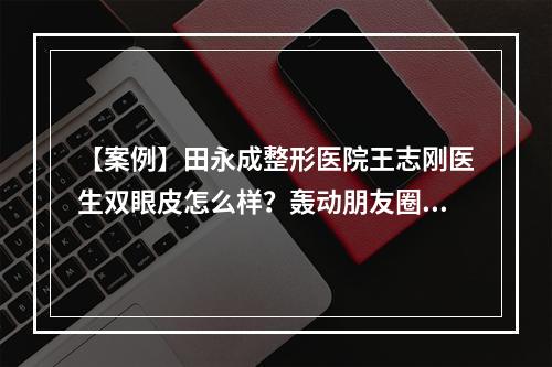 【案例】田永成整形医院王志刚医生双眼皮怎么样？轰动朋友圈！