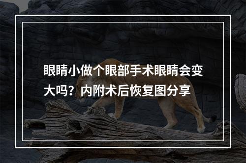 眼睛小做个眼部手术眼睛会变大吗？内附术后恢复图分享