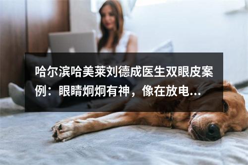 哈尔滨哈美莱刘德成医生双眼皮案例：眼睛炯炯有神，像在放电~