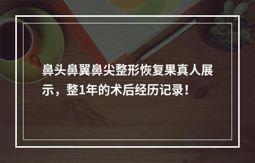 鼻头鼻翼鼻尖整形恢复果真人展示，整1年的术后经历记录！