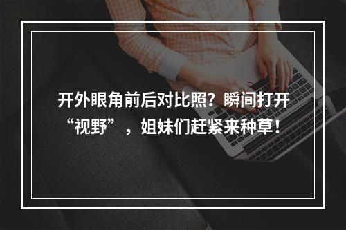 开外眼角前后对比照？瞬间打开“视野”，姐妹们赶紧来种草！