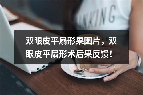 双眼皮平扇形果图片，双眼皮平扇形术后果反馈！