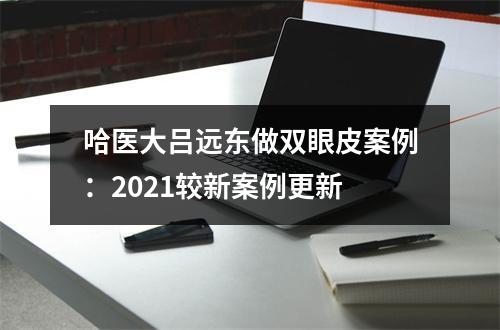 哈医大吕远东做双眼皮案例：2021较新案例更新