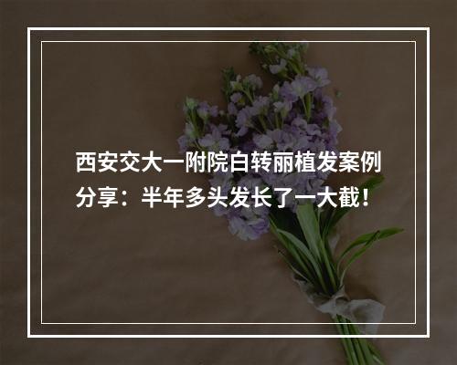 西安交大一附院白转丽植发案例分享：半年多头发长了一大截！