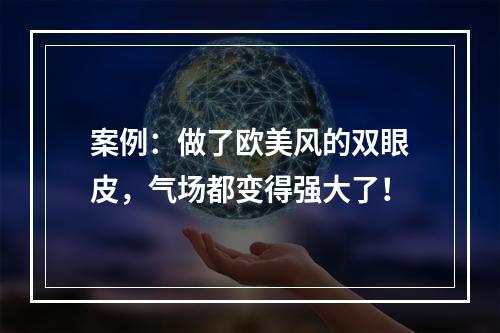 案例：做了欧美风的双眼皮，气场都变得强大了！