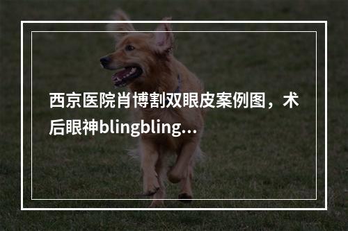 西京医院肖博割双眼皮案例图，术后眼神blingbling~