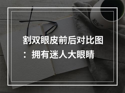 割双眼皮前后对比图：拥有迷人大眼睛