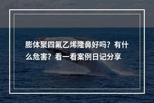 膨体聚四氟乙烯隆鼻好吗？有什么危害？看一看案例日记分享