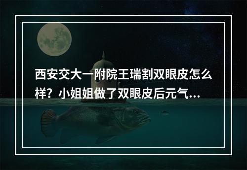 西安交大一附院王瑞割双眼皮怎么样？小姐姐做了双眼皮后元气十足，眼皮十分自然~