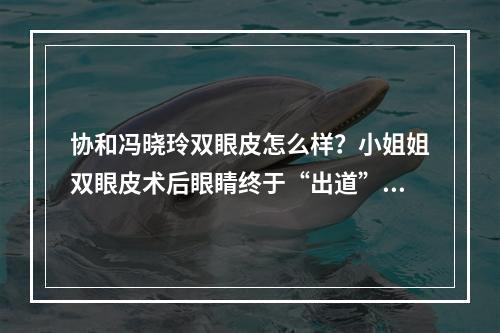 协和冯晓玲双眼皮怎么样？小姐姐双眼皮术后眼睛终于“出道”啦！