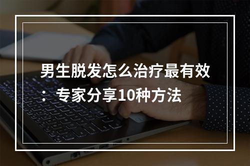 男生脱发怎么治疗最有效：专家分享10种方法