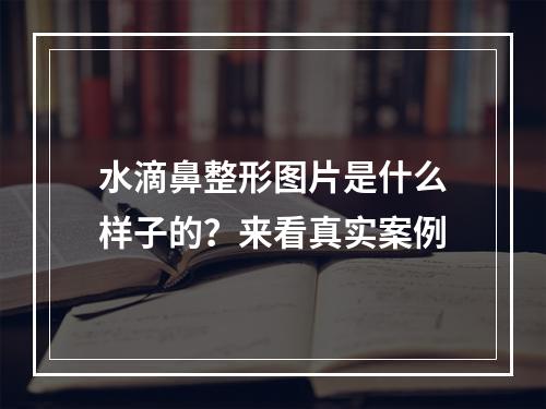 水滴鼻整形图片是什么样子的？来看真实案例