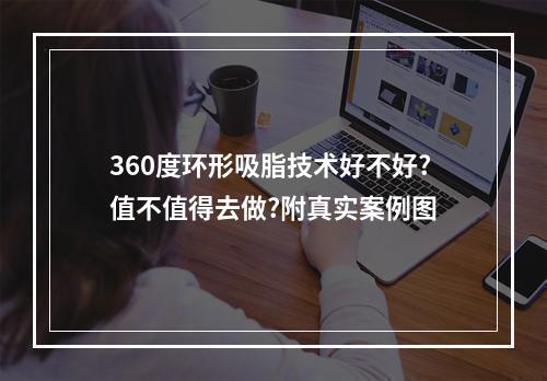 360度环形吸脂技术好不好?值不值得去做?附真实案例图