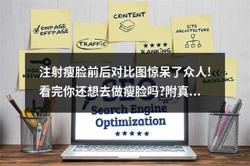 注射瘦脸前后对比图惊呆了众人!看完你还想去做瘦脸吗?附真实案例