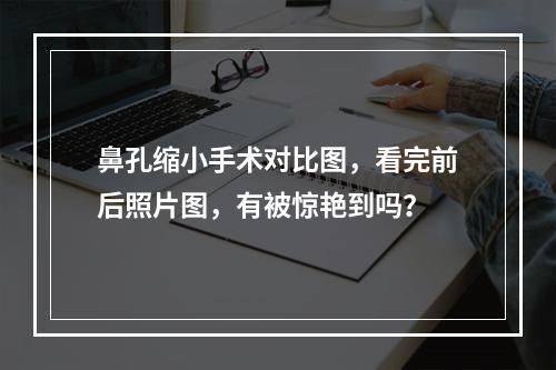 鼻孔缩小手术对比图，看完前后照片图，有被惊艳到吗？