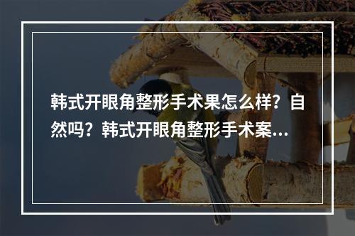 韩式开眼角整形手术果怎么样？自然吗？韩式开眼角整形手术案例