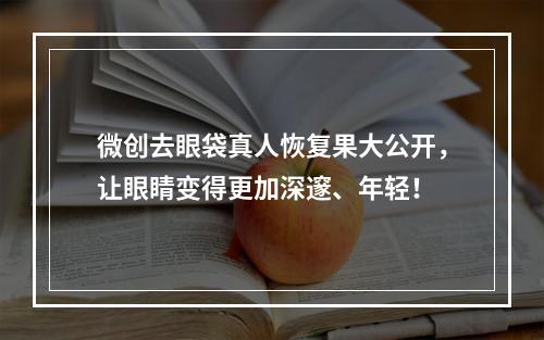 微创去眼袋真人恢复果大公开，让眼睛变得更加深邃、年轻！