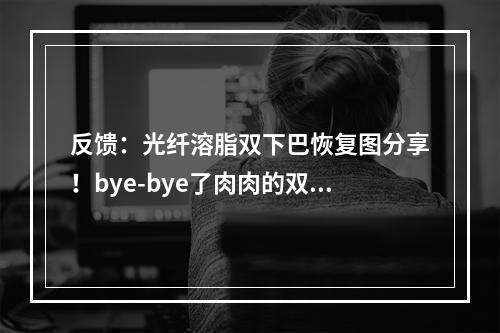 反馈：光纤溶脂双下巴恢复图分享！bye-bye了肉肉的双下巴