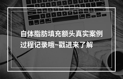 自体脂肪填充额头真实案例过程记录哦~戳进来了解