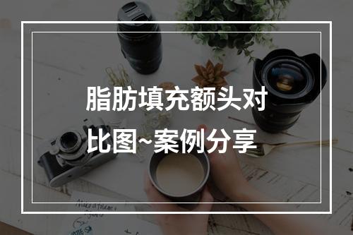 脂肪填充额头对比图~案例分享