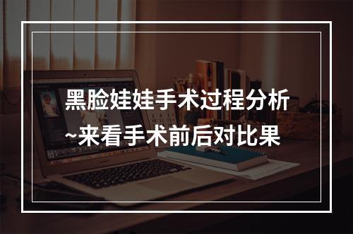 黑脸娃娃手术过程分析~来看手术前后对比果