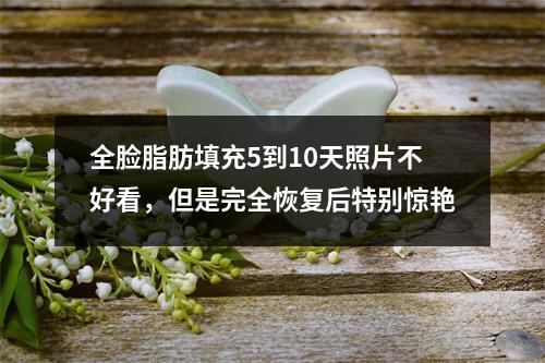 全脸脂肪填充5到10天照片不好看，但是完全恢复后特别惊艳