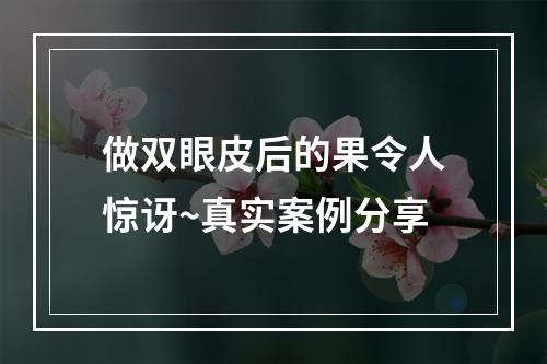 做双眼皮后的果令人惊讶~真实案例分享