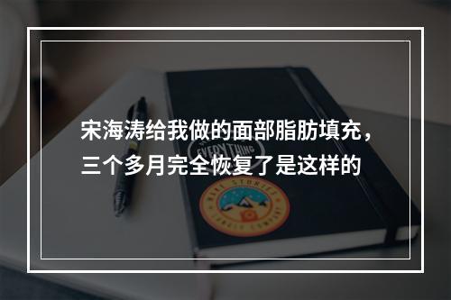 宋海涛给我做的面部脂肪填充，三个多月完全恢复了是这样的