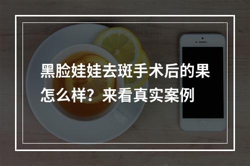 黑脸娃娃去斑手术后的果怎么样？来看真实案例