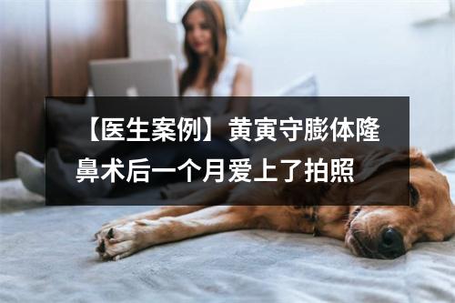 【医生案例】黄寅守膨体隆鼻术后一个月爱上了拍照