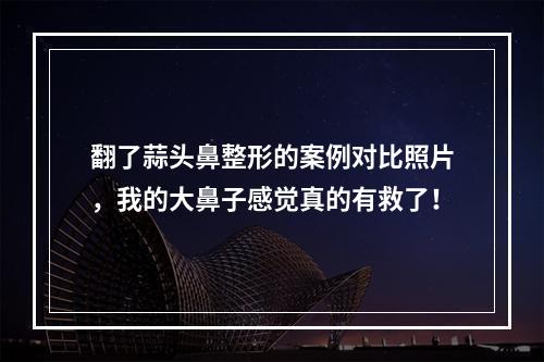 翻了蒜头鼻整形的案例对比照片，我的大鼻子感觉真的有救了！