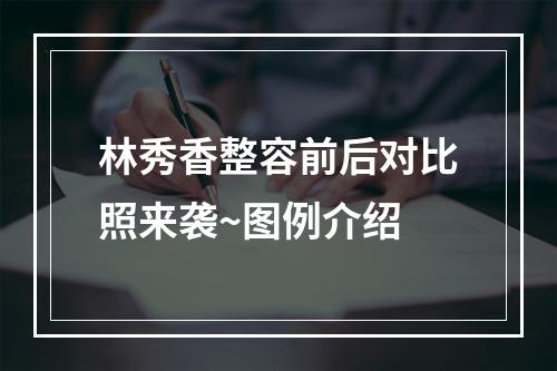 林秀香整容前后对比照来袭~图例介绍