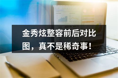 金秀炫整容前后对比图，真不是稀奇事！