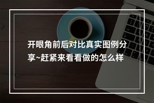 开眼角前后对比真实图例分享~赶紧来看看做的怎么样