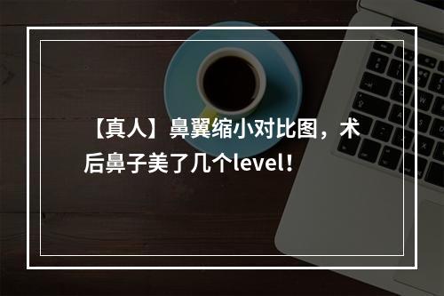 【真人】鼻翼缩小对比图，术后鼻子美了几个level！