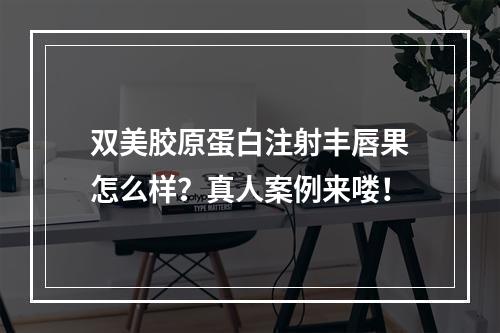 双美胶原蛋白注射丰唇果怎么样？真人案例来喽！