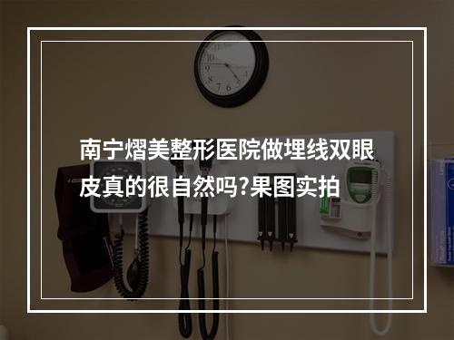 南宁熠美整形医院做埋线双眼皮真的很自然吗?果图实拍