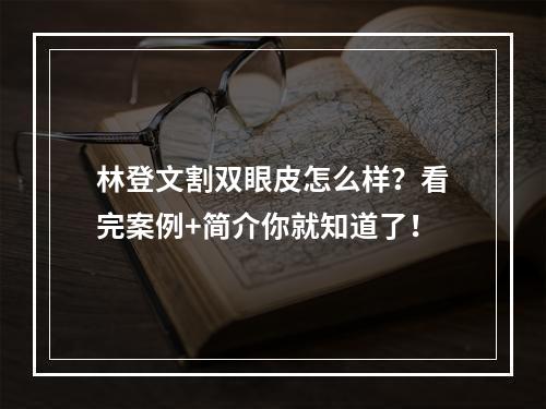 林登文割双眼皮怎么样？看完案例+简介你就知道了！