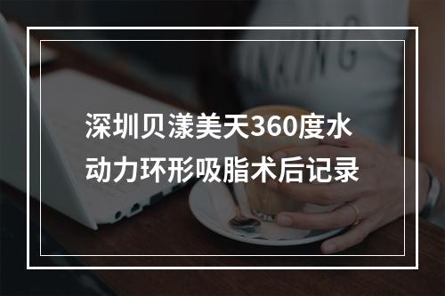 深圳贝漾美天360度水动力环形吸脂术后记录