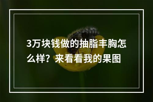 3万块钱做的抽脂丰胸怎么样？来看看我的果图