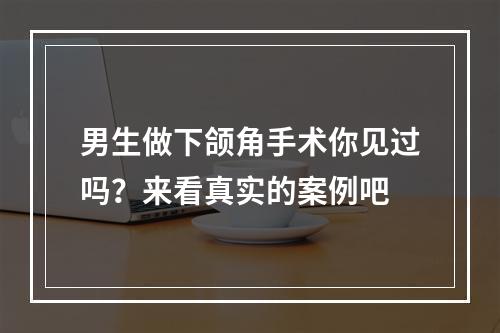 男生做下颌角手术你见过吗？来看真实的案例吧