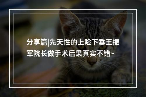 分享篇|先天性的上睑下垂王振军院长做手术后果真实不错~