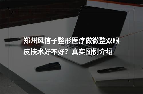 郑州风信子整形医疗做微整双眼皮技术好不好？真实图例介绍