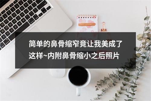 简单的鼻骨缩窄竟让我美成了这样~内附鼻骨缩小之后照片