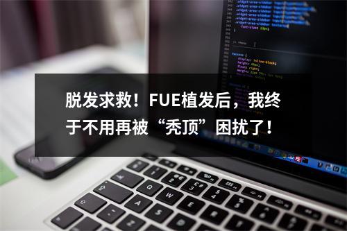 脱发求救！FUE植发后，我终于不用再被“秃顶”困扰了！